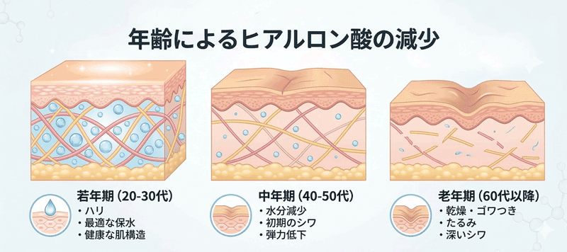 年齢とともに減少するヒアルロン酸（40代・60代・70代のイメージ）